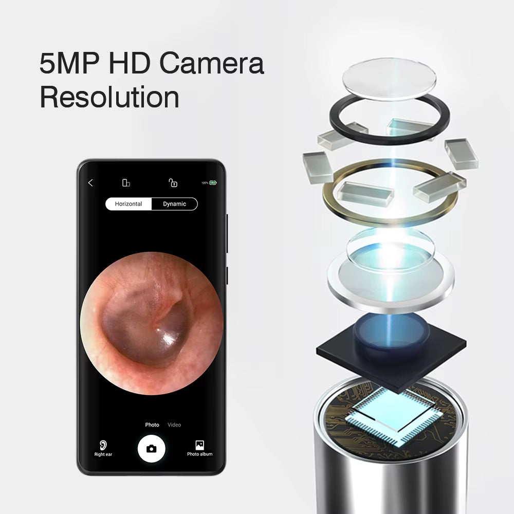 Wireless Visual Ear Endoscope Camera Ear Cleaning Tools Spoon Safe Silicone Earpick 5MP Camera Ear Wax Remover Luminous Otoscope